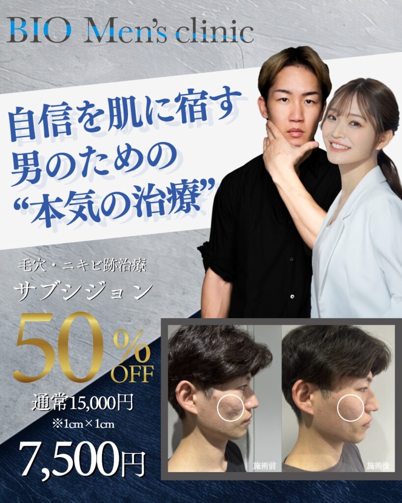 サブシジョン50%OFF