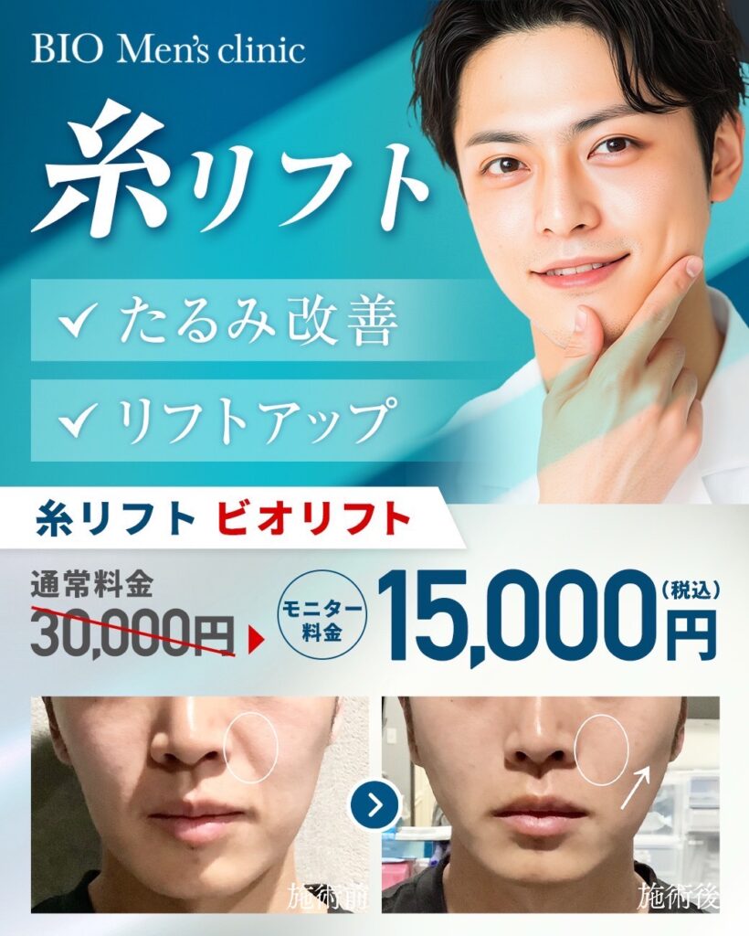 【印象を引き締める】糸リフトキャンペーン