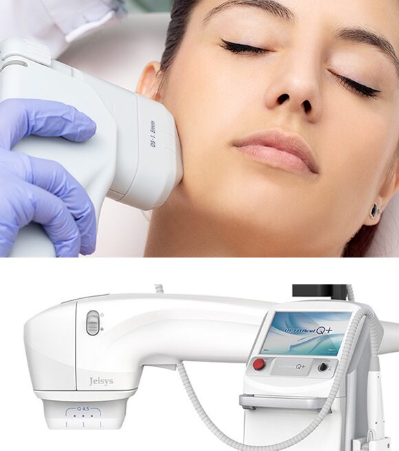 4位：HIFU（ハイフ）｜たるみ・引き締めに