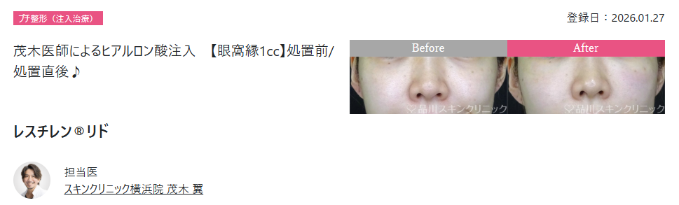 症例数2,030万件超の圧倒的な実績