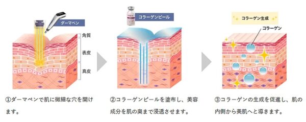 ヴェルベットスキン