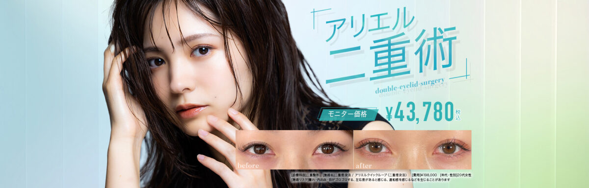 アリエル美容クリニック 二重整形