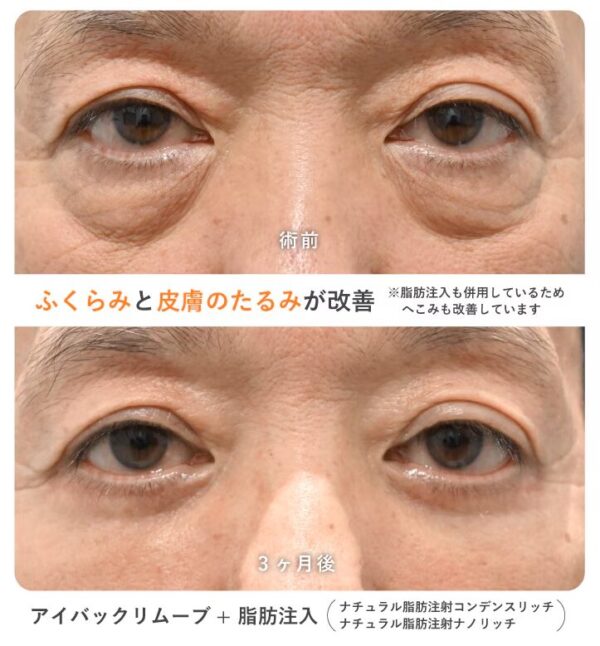症例写真・ビフォーアフターを公式で公開している京都の名医