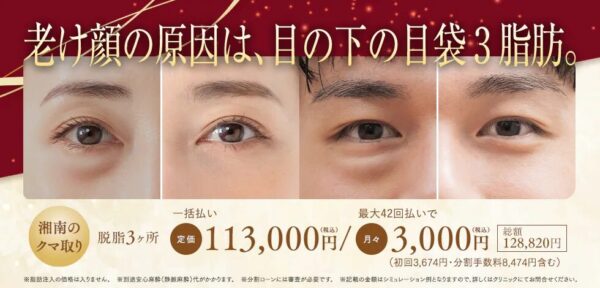 クマ取りの失敗例
