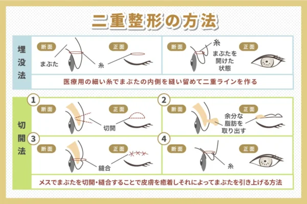 二重_共立美容外科