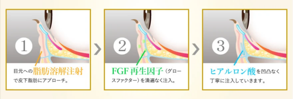 TCB_切らないクマ取り