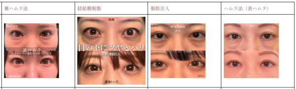 eクリニック_症例