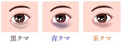 青クマ・茶クマ・黒クマの原因と見分け方