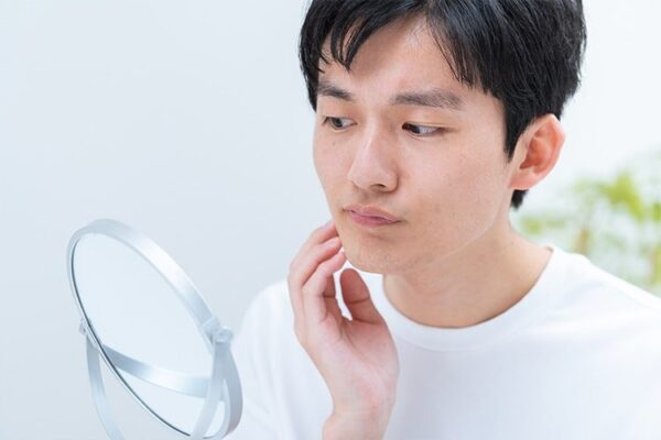 メンズが受ける際の注意点
