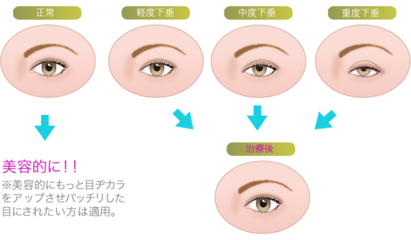 保険適用になる例外的なケース