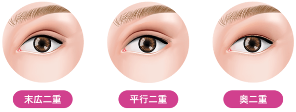 品川美容外科_二重整形