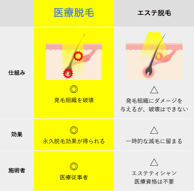 メンズリゼ